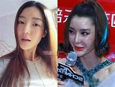 李颖芝整容前